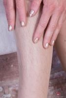 ATK hairy  in mature and hairy