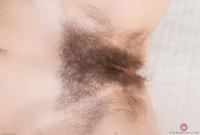 ATK hairy  in mature and hairy