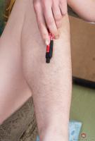 ATK hairy  in mature and hairy