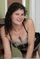 ATK hairy  in mature and hairy