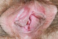 ATK hairy Susanna Set