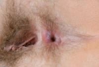 ATK hairy Susanna Set