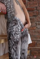 ATK hairy  in mature and hairy