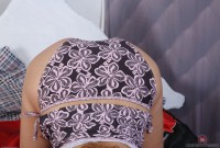 ATK hairy  in mature and hairy