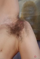 ATK hairy  in mature and hairy