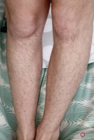 ATK hairy  in hairy fun