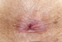 ATK hairy Tali Dova Set