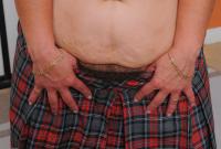 ATK hairy Tanya Tung Set