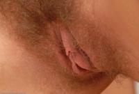 ATK hairy  in young and hairy