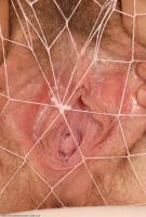 ATK hairy  in young and hairy