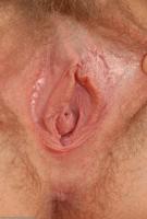 ATK hairy  in young and hairy