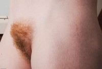 ATK hairy  in young and hairy
