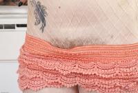 ATK hairy  in young and hairy