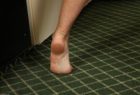 ATK hairy Bianca Stone Set