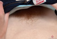 ATK hairy  in mature and hairy