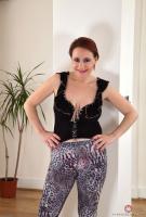 ATK hairy  in mature and hairy