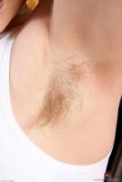 ATK hairy  in mature and hairy