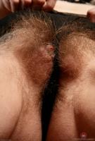 ATK hairy  in mature and hairy