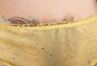 ATK hairy  in mature and hairy