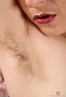 ATK hairy  in mature and hairy