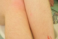 ATK hairy Tracy in scary hairy