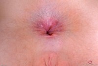 ATK hairy Trillium Set