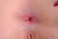 ATK hairy Trillium Set