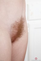 ATK hairy  in young and hairy
