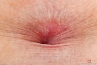 ATK hairy  in young and hairy