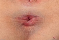 ATK hairy  in young and hairy