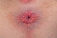 ATK hairy Trillium Set