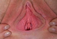 ATK hairy Trillium Set