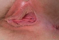 ATK hairy Trillium Set