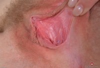 ATK hairy Trillium Set