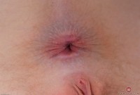 ATK hairy Trillium Set