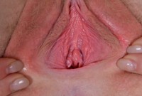 ATK hairy Trillium Set