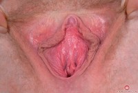 ATK hairy Trillium Set