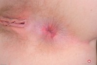 ATK hairy Trillium Set