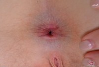 ATK hairy Trillium Set