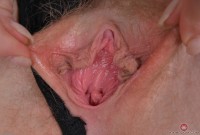 ATK hairy Trillium Set