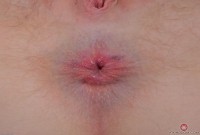 ATK hairy Trillium Set