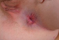 ATK hairy Trillium Set