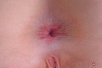 ATK hairy Trillium Set