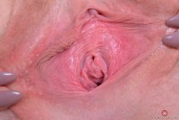 ATK hairy Trillium Set