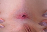 ATK hairy Trillium Set