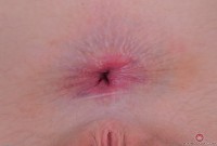 ATK hairy Trillium in young and hairy