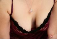 ATK hairy  in mature and hairy