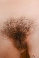 ATK hairy  in mature and hairy
