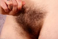 ATK hairy Urtica Set