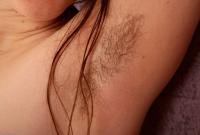 ATK hairy Urtica Set